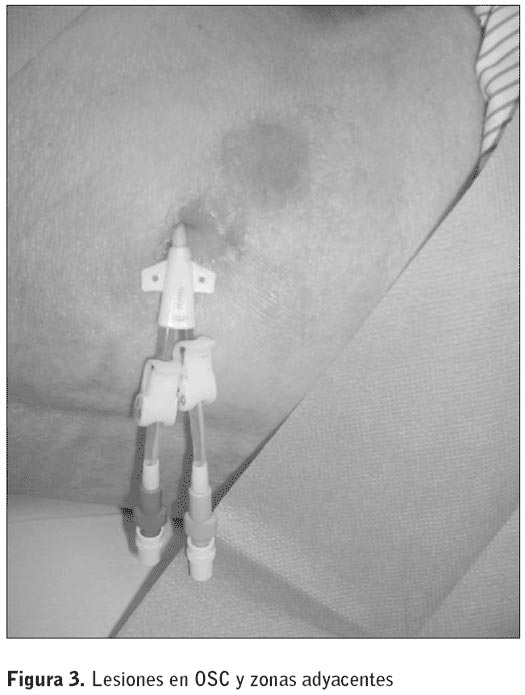 Figura 3