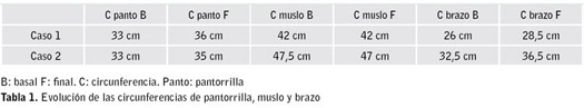 Tabla 1