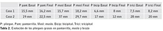 Tabla 2